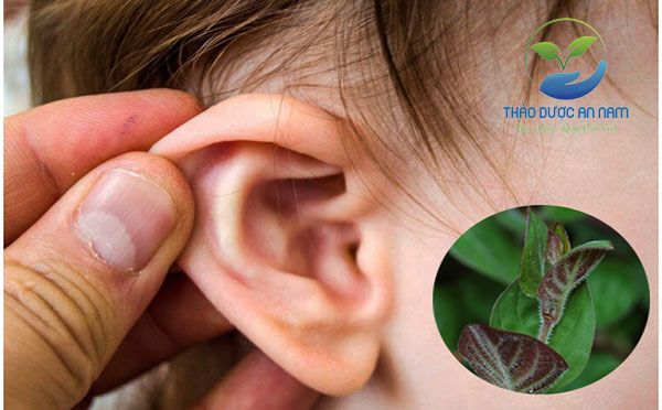 Cách chữa viêm tai giữa tại nhà bằng lá mơ